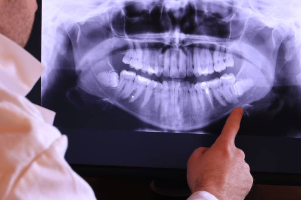 Best Emergency Dentist for Lost Fillings or Crowns in Rocky River, OH