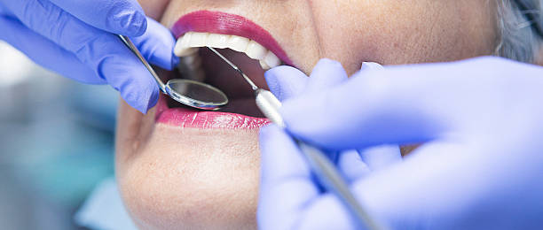 Best Emergency Dentist for Knocked-Out Tooth in Rocky River, OH